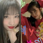 Momo (TWICE) khiến fan hoang mang khi kể chuyện phẫu thuật, nhưng nhan sắc trong bức ảnh đi kèm mới gây chú ý
